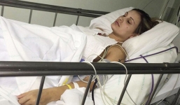 Lạm dụng phẫu thuật thẩm mỹ Á hậu siêu vòng 3 sắp mất chân